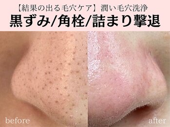 メルシア(merucia)