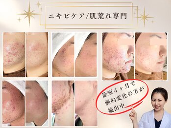 ビューティーホリック 蘇我店(BEAUTY HOLIC)