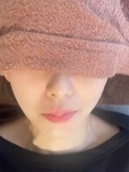 いちごいちえの写真/むくみ・たるみ・フェイスラインのケアに！小顔矯正で施術直後から変化を実感◎