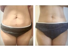 ビアテリエ(美 atelier)の雰囲気(ご来院8ヶ月目のビフォーアフター写真です!姿勢も整いました^_^)