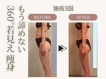 ミービレイ(Mie美戻)