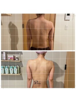 プルクレ 常磐町店(Pulchre)/ビフォーアフター♪