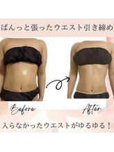 サロン ド ボーテ ラーンジュ 岐阜店(salon de beaut'e L'ange)/ハイパ-ナイフEX2ダイエット痩身