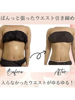 サロン ド ボーテ ラーンジュ 岐阜店(salon de beaut'e L'ange)/ハイパ-ナイフEX2ダイエット痩身