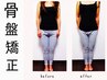 【産後骨盤矯正×整体】産後4週~ダイエット/疲労回復/ポッコリ腹60分¥8,800⇒