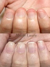 マリーロール 梅田店(Marie Laure)/深爪矯正/自爪育成/自爪風