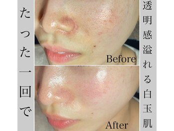 ブラックボックス(BLACK BOX)