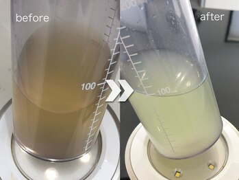 ウルト アルティメイトスキン(ULT ultimate skin)/毛穴のお悩みありませんか?