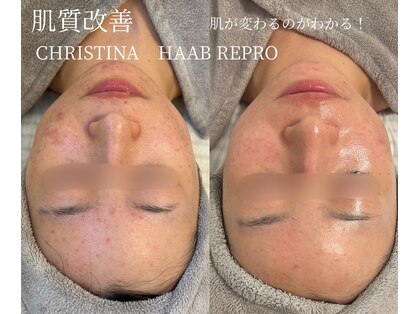 シェア(share.)の写真