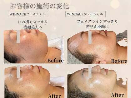 ヴィタベラ(Vita Bella)の写真