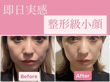 グリシーヌ(Glycine.)の雰囲気（頭皮をほぐし、リフトアップだけでなく根本小顔を体感頂けます♪）