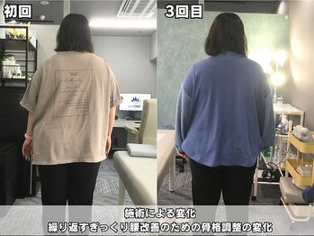 整体院 ワン(ONE)/初回施術による変化