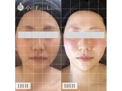 小顔フェイスラボ 浜松店(小顔FaceLabo.)の写真