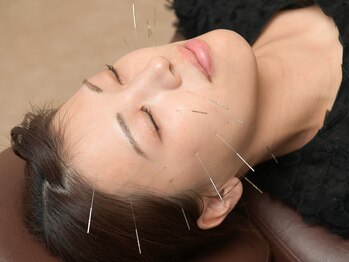 たくあん鍼灸院の写真/【姿勢から整える美容鍼】たるみ・ほうれい線・食いしばり・むくみをケアし、姿勢から整えて若々しい姿に！