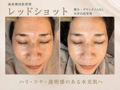 ビーマジック(Be Magic)の写真