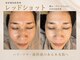ビーマジック(Be Magic)の写真
