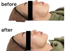 ビーエフジー(B F G)/二重あごケアもご相談ください☆