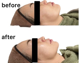 ビーエフジー(B F G)/二重あごケアもご相談ください☆