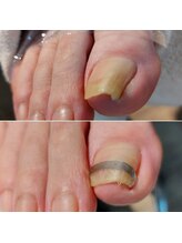 爪切り屋 足楽/爪ケア40分＋ＰＢスパンゲ