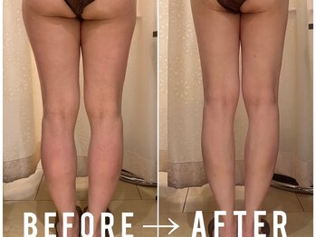 ビュール 銀座(BeauL)/ブライダルエステ/痩身