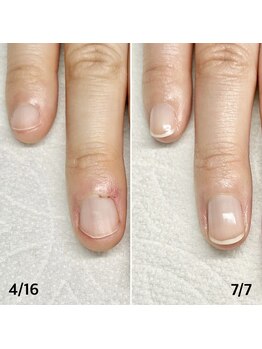 スペシャル ケー(Special K)の写真/健康な地爪を作り二人三脚で地爪育成するパーソナルケアコース初回体験¥6500♪爪のコンプレックスを解消◎