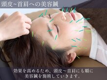 ハリラウンジ 恵比寿本店(Hari Lounge)/美容鍼専門サロン Hari Lounge