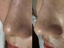 サラグランデ(Sara Grande)/ビフォーアフター