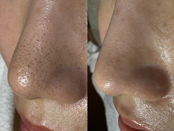 サラグランデ(Sara Grande)/ビフォーアフター