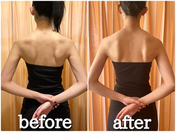 癒楽/肩甲骨はがしで天使の羽を！