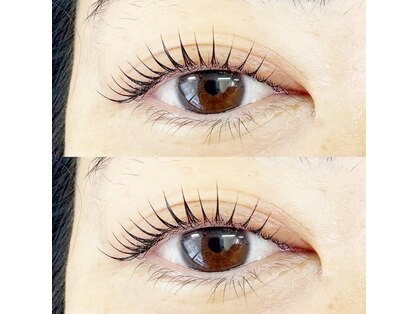 パトラ(PATRA)の写真