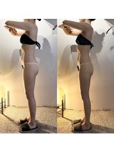 ヴェレン(Wellen)/ビフォーアフター