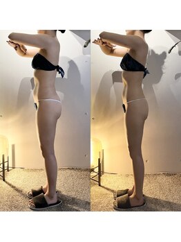 ヴェレン(Wellen)/ビフォーアフター