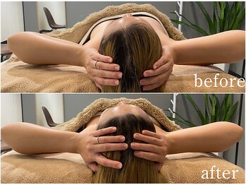 ルナリア ルクス 志木南口駅前店/驚きのビフォーアフター!小顔!