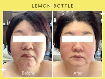 シロカネ イオンタウン西熊本店(SHIROKANE)/レモンボトル☆