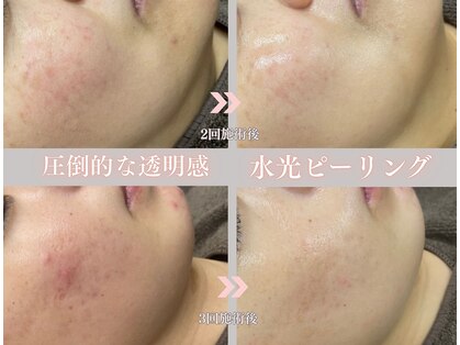 ミレット(Miretto)の写真