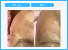 トウメイコガオ 横浜店/