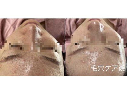 アイヅキ(AIZUKI)の写真