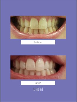 マルク(MARQUE)/15分×2セットで2トーンUP!!