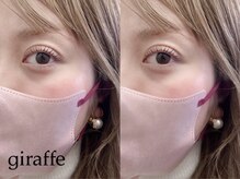 ジラフ(giraffe)/【ラッシュリフト】立ち上げ