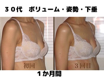 バストサロン メルベイユ(Merveile)/ボリュームUP・ブラ隙間埋まる