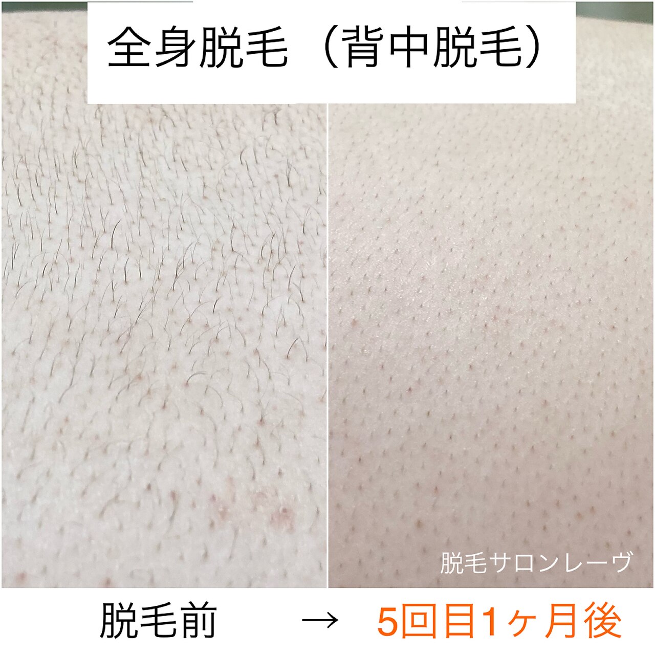 神戸市西区で人気のエステサロン｜ホットペッパービューティー