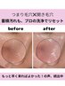 【平日16時まで】毛穴の黒ずみ角栓ごっそり!全顔毛穴洗浄★ニキビ予防も