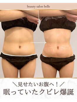 ベル(belle)の写真/満足いかなかった方必見！bell式脂肪冷却でダイエットはじめませんか★直接脂肪にアプローチ♪