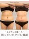 ベル(belle)の写真/満足いかなかった方必見！bell式脂肪冷却でダイエットはじめませんか★直接脂肪にアプローチ♪