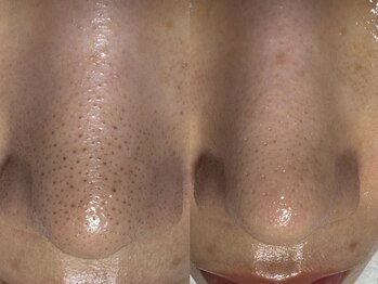 サラグランデ(Sara Grande)/ビフォーアフター