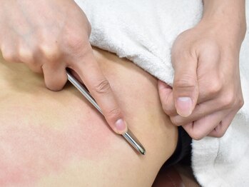 いりや鍼灸整骨院の写真/【疲労/腰痛/姿勢改善◎】国家資格者によるボキボキしない骨盤矯正+筋膜リリース★歪みを整え快適な身体へ!