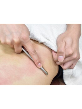 接骨院・整骨院で施術を受けたい