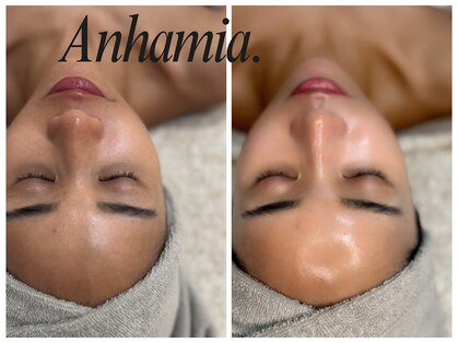 アンハミア 表参道(Anhamia.)の写真