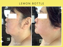 シロカネ イオンタウン西熊本店(SHIROKANE)/レモンボトル☆