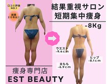 エストビューティー 池袋店(EST BEAUTY)の雰囲気(池袋の人気痩身サロン!口コミ評価◎!短期でサイズダウン!)